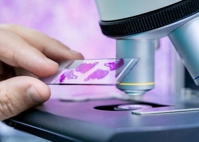 Interpretacja wyników badania cytologicznego z wykorzystaniem skali Papanicolau oraz systemu Bethesda